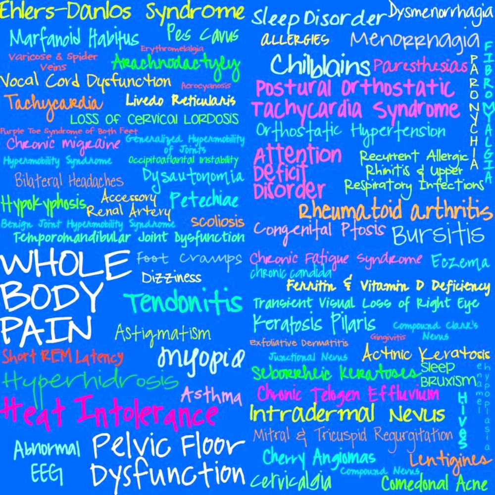 Finally diagnosed with Ehlers Danlos Syndrome
